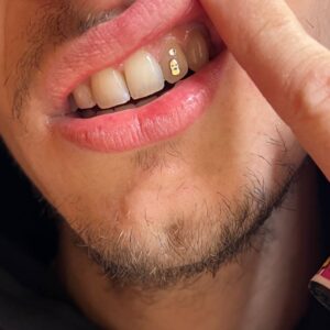 GEMA DENTAL DISEÑO EXCLUSIVO